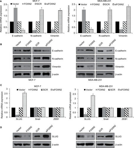 Figure 4 FOXN2 represses EMT in breast cancer through regulation of SLUG.Notes: (A) and (B) FOXN2 was overexpressed or knocked down in MCF-7 and MDA-MB-231 cells. RT-qPCR (A) and Western blotting (B) analyses demonstrated that ectopic expression of FOXN2 resulted in increased E-cadherin expression levels and reduced expression of N-cadherin and vimentin; however, inhibition of FOXN2 resulted in decreased E-cadherin expression levels and increased expression of N-cadherin and vimentin. *P<0.05 vs vector or SCR group. (C) FOXN2 was overexpressed or knocked down in MCF-7 and MDA-MB-231 cells. RT-qPCR analysis demonstrated that ectopic expression or inhibition of FOXN2 had no significant effect on snail and ZEB1 expression, while SLUG expression was regulated by FOXN2. *P<0.05 vs vector or SCR group. (D) FOXN2 was overexpressed or knocked down in MCF-7 and MDA-MB-231 cells. Western blotting analysis demonstrated that the SLUG expression was regulated by FOXN2.Abbreviations: EMT, epithelial–mesenchymal transition; FOXN2, forkhead box N2; RT-qPCR, quantitative reverse transcription PCR; SCR, scramble siRNA; si, siRNA.