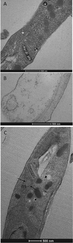 Figure 6. Transmission electron microscopy of L. infantum promastigotes. (A) Untreated control; (B and C) treated with compound 3 (46 µM). Observe the disruption caused by the compound (B) and the mitochondrial crest alterations (arrows in C).