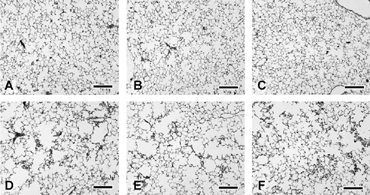 Figure 5 Left lung parenchyma from female B6C3F1 mice exposed to filtered air (control; A, B, and C) or to cigarette smoke (D, E, and F) for 32 weeks followed by nose-only inhalation treatment with ethanol vehicle (A, D), 180 mg-minutes ATRA/m3 (B, E), or 1,800 mg-minutes ATRA/m3. Note irregular alveolar air space expansion in all cigarette smoke-exposed groups without any improvement following 3 weeks of ATRA treatment. Bars = 200 µm.