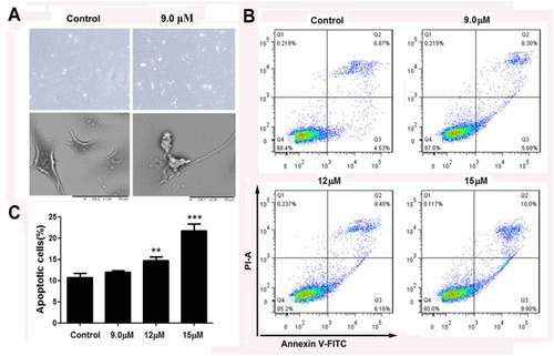 Figure 4 Apoptosis of MG63 cells following treatment with apiosporamide.Notes: (A) SEM micrographs of apiosporamide-treated MG63 cells for 24 hrs. (B) Apoptosis was determined by an Annexin V-FITC/PI apoptosis detection kit, and representative results from flow cytometry were shown. (C) Quantitative analysis of apoptosis of MG63 cells as shown in (B). Values were presented as mean±SD (n=3). **P<0.01 and ***P<0.001 vs normal control.Abbreviations: SEM, screening electron microscope; Annexin V-FITC, annexin V fluorescein isothiocyanate; PI, propidium iodide.