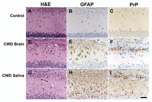 Figure 5 Neuropathology of brain sections from Tg(ElkPrP) mice inoculated with saliva (G–I) or with brain homogenate (D–F) from mule deer with CWD. Brain sections from uninoculated, 658-d-old, control Tg(ElkPrP) mice are shown as controls (A–C). Sections show vacuolation (left column), astrocytic gliosis (middle column), and PrPSc deposition (right column). Some Tg(ElkPrP) mice inoculated with saliva from CWD-positive mule deer developed neurologic symptoms, showed vacuolation (G), severe gliosis (H) and PrPSc deposits (I). Mice inoculated with brain homogenate from mule deer with CWD showed vacuolation (D), reactive astrocytic gliosis (E) and PrPSc deposits (F). Control mice showed no vacuolation (A), no gliosis (B) and no PrPSc deposits (C). Bar in I represents 50 µm and applies to all parts.