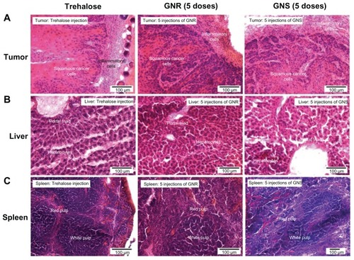 Figure 4 Light microscopy images of H&E stained tumor, liver and spleen from mice that received five doses of GNSs and GNRs and a dose of trehalose (control).Abbreviations: GNS, gold nanoshells; GNR, gold nanorods; H&E, hematoxylin and eosin.