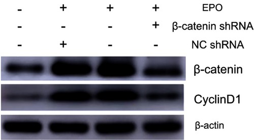 Figure 10 The protein level of β-catenin and CyclinD1 was assessed by Western blot analysis. (Osteogenic induction group, EPO group, EPO+NCshRNA group and EPO+β-catenin shRNA group).