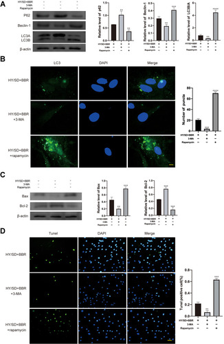 Figure 3 Apoptosis of ADSCs induced by HY/SD conditions can be affected by autophagy. (A) Western blot assay of autophagy related proteins expression in ADSCs incubated with rapamycin and 3-MA separately, followed by BBR pretreatment for 2 h before hypoxia. β-actin served as a control. (B) LC3 immunofluorescence in ADSCs for different processing groups (Scale Bar = 5 μm). (C) Western blot assay of Bax and Bcl-2 expression in ADSCs for different processing groups. β-actin served as a control. (D) Tunel assay in different treatment ADSCs groups. Data were mean ± SEM (n = 3). (**P < 0.01; ***P < 0.001; ****P < 0.0001 vs HY/SD+BBR group).