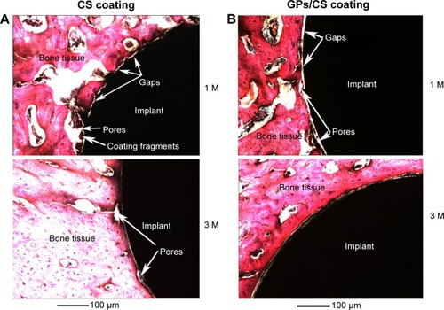 Figure 7 Histological sections of the CS coating (A) and GPs/CS coating (B) after implantation for 1 M and 3 M.Abbreviations: M, month(s); GPs, graphene plates; CS, calcium silicate.