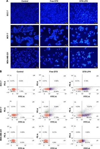 Figure 5 (A) Nuclear apoptosis assay using confocal laser scan microscopy, (B) Cell apoptosis by flow-cytometric analysis after treatment for 24 h with free DTX or DTX-LPH nanoparticles. DTX concentration was 10 μg/mL on SCC-7 and MCF-7 cells and 25 μg/mL on MDA-MB-231 cells.Abbreviations: DTX, docetaxel; LPH, lipid polymer hybrid; DTX-LPH, docetaxel-loaded lipid polymer hybrid; h, hours.