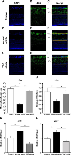 Figure 3 The effect of TBE on autophagy. A comparison of LC-3 immunofluorescence (green) when the control mice (A–C) and ob/ob mice were fed with a normal diet (D–F) or diet containing TBE (G–I). In the diabetic retina of mice fed with a normal diet, compared with the control mice, we found that staining in the IPL was attenuated ((E and F), within the yellow line). In the diabetic retina of TBE ob/ob mice, compared with the normal ob/ob mice, LC-3 expression was significantly increased ((H and I), within the yellow line). Retinal qPCR was examined for LC-3, AKT1, and WNK1. Compared with the control mice, in normal ob/ob mice, LC-3 expression was significantly reduced; however, in TBE ob/ob mice, compared with normal ob/ob mice, the expression was significantly increased (J). Furthermore, compared with the control mice, in normal ob/ob mice, AKT1 and WNK1 expression levels were significantly increased; however, in TBE ob/ob mice, compared with normal ob/ob mice, the expression was significantly reduced (K and L). Values are expressed as means ± SD. *P < 0.05. Nuclei were counter-stained with DAPI (blue).