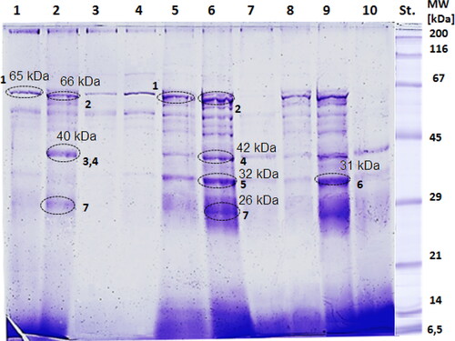 Figure 2. Denaturating 10% SDS-PAGE of proteins isolated from S. cerevisiae in Log and G0 phase: lane 1 Log phase treated with H2O2; lane2 G0 phase treated with H2O2; lane 3 Log phase treated with 100 µmol/L menadione; lane 4 G0 phase treated with 100 µmol/L menadione; lane 5 Log phase treated with 1.1 mg/mL ibuprofen; lane 6 G0 phase treated with 1.1 mg/mL ibuprofen; lane 7 Log phase treated with 50 µg zeocin; lane 8 G0 phase treated with 50 µg zeocin; lane 9 control in Log phase; lane 10 control in G0 phase; St: Standard from Serva.