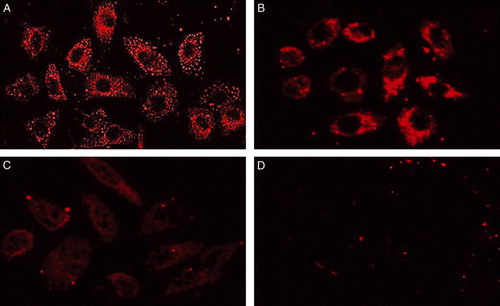 Figure 2.  Micrographs of localization of FAS in breast cancer cells. Cells grown in chamber slides were fixed and stained with anti-FAS antibody by the indirect immunofluorescent method. A. SK-Br3 cells; B. MCF-7 cells; C. MDA-MB-231 cells; D. negative control. FAS localizes primarily in the cytosol of cultured SK-Br3, MCF-7 and MDA-MB-231 breast cancer cells. ×400