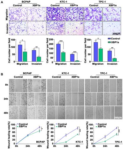 Figure 3 Overexpression of XBP1s reduces the invasive and metastatic potential of PTC cells, and inhibits EMT in PTC cells. (A) Cell migration and invasion assay. (B) Wound healing assay. Difference between two groups was tested using two-tailed Student’s T-test. Data are expressed as the mean ± SD of each group of cells from three separate experiments. *P<0.05; **P<0.01; ***P<0.001.