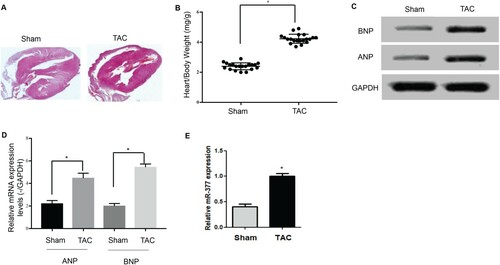 Figure 1. Increased miR-377 expression in hypertrophic cardiomyopathy. (A) Heart/body weight ratio in the TAC and sham groups. (B) Protein expression of ANP and BNP in the TAC and sham groups. (C) mRNA expression of ANP and BNP in the TAC and sham groups. (D) Levels of miR-377 expression in the hearts of mice in the TAC and sham groups as detected by qRT-PCR.