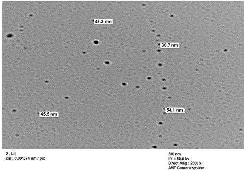 Figure 6 TEM image for selenium nanoparticles synthesized by using compound 2g at room temperature.Abbreviation: TEM, transmission electron microscope.