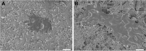 Figure 4 SEM images of hPDLSCs on HA (A) and mnHA (B) after 6 hours of seeding.Note: Scale bar =10 μm.Abbreviations: SEM, scanning electron microscopy; hPDLSC, human periodontal ligament derived stem cell; HA, hydroxyapatite; mnHA, micro-nano-hybrid surface.