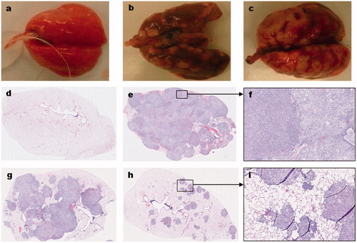 Figure 4. Gross and histological features of orthotopic lung tumors in rats. The gross (a–c) and microscopic (d–i) features of normal lung (a,d), A549-derived tumors (b,e–i), and H1975-derived tumors (c) are shown. Compared to the normal lungs (a) of an age-matched, cancer-free, and treatment naïve rat; the A549 (b) and H1975 (c) derived tumor-bearing lungs from untreated control animals have grossly visible, multinodular, tan-gray, masses that bulge from the pleural and visceral surfaces of the lungs, respectively. Microscopic evaluation of hematoxylin and eosin (H&E) stained sections from A549-derived tumor-bearing lungs (e–i) revealed that the lung parenchyma, smaller airways, and blood vessels are invaded by patches of cancer cells. In a vehicle-treated animal, the entire lung lobe is filled with tumor cells of mainly two types (a smaller or larger cytoplasm) and very little normal airspace is left (e,f). In a rat treated with IV topotecan, about half the lung lob is filled with patches of cancer cells that started to coalesce (g). In contrast, about 90% of the lung parenchyma of a rat treated with inhaled topotecan remained normal and the tumor nodules are much smaller and mostly noncoalescent (h,i).