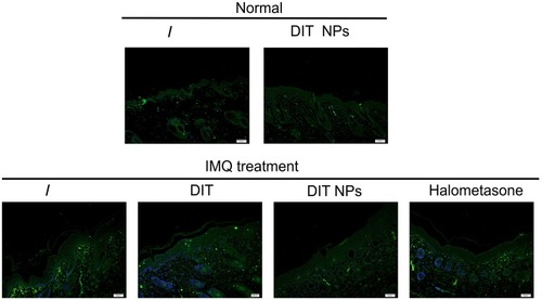 Figure 6 The representative staining of TNF-α in psoriatic skins after different treatments including the healthy skin of normal mice, the diseased skin of psoriasis mice, the skin of psoriatic mice treated with DIT, DIT@NPs and Halometasone.