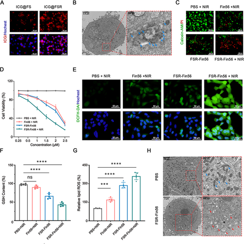 Figure 4 Hyperthermia-boosted chemodynamic effect induced amplified ferroptosis. (A) Fluorescence images of MNNG/HOS cells after a 4-hour incubation with ICG@FS or ICG@FSR NPs. (B) TEM image of MNNG/HOS cells treated with FSR. The blue arrows indicated the FSR NPs. (C) Fluorescence images of MNNG/HOS cells stained with Calcein-AM and PI after different treatments. (D) Cell viability of MNNG/HOS cells at 24-hour after corresponding treatments. (E) Fluorescence images of MNNG/HOS cells stained with DCFH-DA after various treatments. Relative cellular GSH (F) and LPOs (represented by MDA content) (G) levels of MNNG/HOS cells after corresponding treatment (***P<0.001, ****sP<0.0001). (H) TEM images of MNNG/HOS cells after different treatments. The blue and red arrows indicated relative normal and damaged mitochondria, respectively.