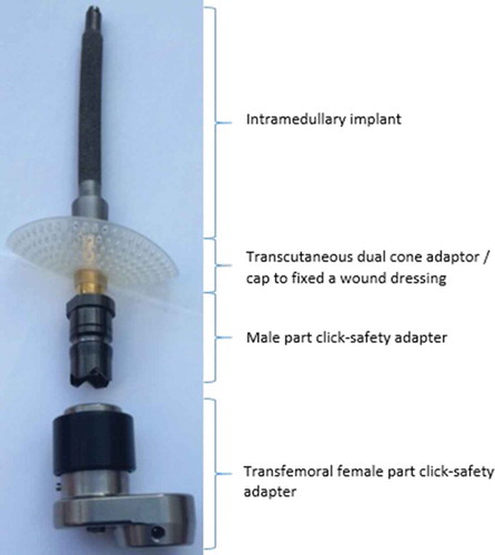 Figure 1. Bone-anchored prosthesis and click-safety adapter.