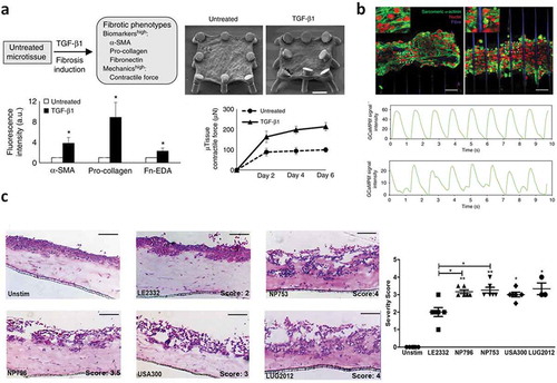 Figure 3. (a) Recapitulation of tissue fibrogenesis in lung microtissues. TGF-β1 treatment induced strong expressions fibrosis biomarkers (α-SMA stress fibers, cytosolic pro-collagen, and EDA-Fibronectin (Fn)), while SEM images of a time-lapse microscopy showed elevated contraction of the fibrotic tissue (scale bar: 200 µm). Reprinted from reference [Citation52] with permission (http://creativecommons.org/licenses/by/4.0/) (b) Cardiac microtissues assembled on fiber matrices from healthy and MYBPC3 deficient cells (scale bar: 50 µm). Confocal images showed no structural disarray but calcium dynamics showed clear abnormalities. Reprinted from reference [Citation53] with permission. (c) Lung tissue models to evaluate the severity of the damaged produced by several strains of Staphylococcus aureus found in patients with pneumonia. Reprinted from reference [Citation58] with permission (http://creativecommons.org/licenses/by/4.0/).