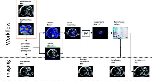 Figure 1. Online workflow on the 1.5T MR-linac.PV, position verification; calc, calculations.