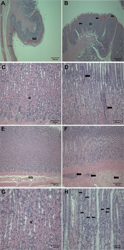 Figure 4 Histopathological changes in the stomach after treatment with ZnOAE100(+) at a dose of 500 mg/kg for 90 days. Stomach sections were stained with hematoxylin and eosin. (A) Control for limiting ridge. (C, E and G) Control for mucosa in glandular stomach. (B, D, F and H) 500 mg/kg treatment groups.aNote: aArrows in (B) represent squamous cell vacuolation, in (D) show eosinophilic chief cells, in (F) indicate submucosal edema and inflammatory cell infiltration, and in (H) represent intracytoplasmic hyaline droplets.Abbreviations: H, squamous cell hyperplasia; N, normal mucosa; NE, normal epithelium; NS, normal submucosa; ZnO, zinc oxide; ZnOAE100(+), 100 nm positively charged ZnO.