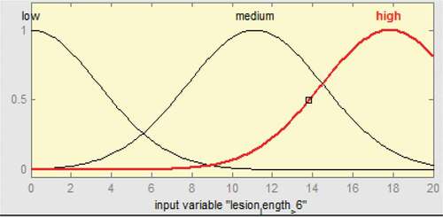 Figure 9. Membership functions of ulcer length ≥ 6 mm