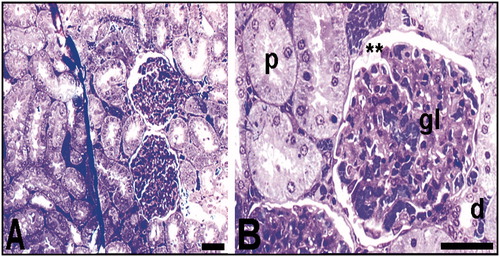 Figure 6. Light microscopy of renal tissue samples which obtained from control group. The general appearance of the kidney of the control group (A); p, proximal tubule; d, distal tubule; gl, glomerulus; **Bowman's space (B). Bars show 50 μm.