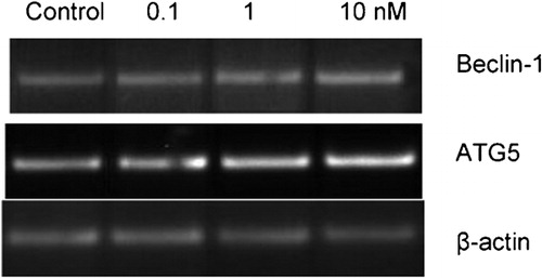Figure 1. mRNA levels of autophagy specific genes in response to imatinib in K562 cells. 0·1, 1, and 10 nM imatinib were applied to K562 cells for 72 hours and expression levels of autophagy specific genes were determined by RT‐PCR. Expression levels of beta‐actin were detected as an internal positive control.