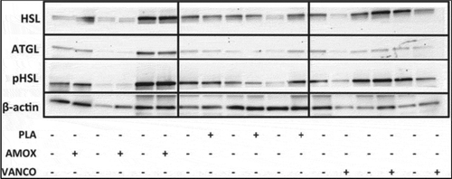 Figure 3. Representative Western Blot for lipolytic markers in human adipose tissue. Membranes were probed with antibodies directed against total ATGL, total HSL, phosphorylated HSL (pHSL) on Ser563 (corresponding to human Ser552). Jocken et al., p. 110.
