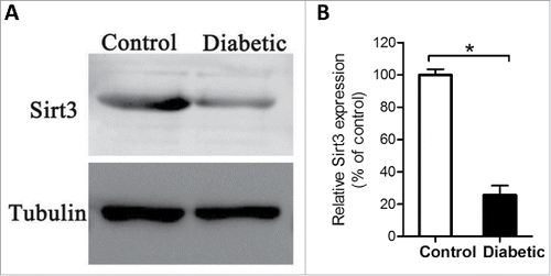 Figure 2. Reduced Sirt3 expression in oocyte from diabetes mice. Fully-grown GV oocytes were collected from control and diabetic mice, and then processed for immunoblotting. (A) Western blot analysis showed the reduced Sirt3 expression in oocytes from diabetic mice compared with controls. Tubulin served as an internal control. (B) Band intensity was measured by Image J software, and the ratio of Sirt3/Tubulin expression was normalized. All protein gel blot experiments were repeated at least 3 times, with a representative gel image shown.
