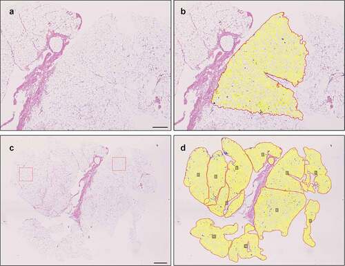 Figure 5. The QuPath based method is applicable for analysis of large adipocyte areas as well. A-B: Illustration of QuPath-based method finding the adipocytes in a larger area (7.1x10E6 µm2). Scale bar 500 µm. C-D: Analysing the whole slide requires more effort but can be achieved in pieces on an average powered workstation (total area 62x10E6 µm2). Red boxes (10E6 µm2) demonstrate areas used for basic analyses with ImageJ + Adipocyte Tools plugin. Scale bar 1,000 µm.