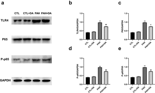 Figure 8. Effects of Dapagliflozin on the expression of TLR4/P65 signal pathway. Representative Western blots (a). Quantitative results of TLR4 (b), P65 (c), P-p65 (d), p65/P-p65 (e) (n = 3 each group). Data are presented as mean as ±SEM. *P < 0.05 vs. CTL group, #P < 0.05 vs. PAH group. **P < 0.01 vs. CTL group, ##P < 0.01 vs. PAH group. Abbreviations: TLR4, toll-like receptor 4; p65, nuclear factor kappa B; P-p65, P-nuclear factor kappa B.