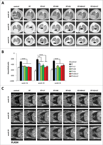 Figure 2. PDGF and TGFβ signaling inhibition reduce radiological signs of pulmonary fibrosis after irradiation. (A) Sample CT images of mouse thoraces at 16, 20 and 24 weeks after irradiation and treatment with galunisertib (LY), imatinib (IM) or SU9518 (SU). Black arrows indicate areas of increased lung density. (B) Quantification of mouse pulmonary density at three different time points after treatment with ionizing radiation and PDGF or TGFβ inhibitors. Average density was measured in Hounsfield units from four standardized regions of interest at the level of the tracheal bifurcation. Graphs depict mean values +/− standard deviation. Statistical analysis was performed by 2-tailed Student's t-test. *p < 0.05; ***p < 0.001. (C) T1-weighted FLASH MRI images of mouse thoraces taken at 16, 20 and 24 weeks after irradiation and treatment with galunisertib (LY), imatinib (IM) or SU9518 (SU).