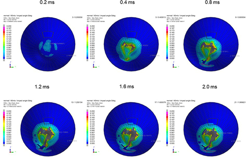 Figure 12 Sequential strain strength response of ocular surface of model eye upon airbag impact in straight position at 40 m/s with adhesion strength of scleral flap of 100%, shown at 0.4-ms intervals after 0.2 ms. Strain strength change is displayed in color as presented in the color bar scale (Figure 2).