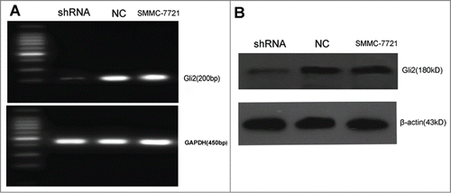 Figure 1. Gli2-specific shRNAs suppressed the expressions of Gli2 mRNA and protein in SMMC-7721 cells. (A) The level of Gli2 mRNA was assessed by semi-quantitative RT-PCR. Total RNA was extracted from SMMC-7721-shRNA, SMMC-7721-NC, SMMC-7721. GAPDH was used as a normalization control. (B) The level of Gli2 protein expression was assessed by Western blot. β-actin was used as a loading control. Densitometric analysis was performed using Quantity one 4.6.2 software. *P < 0.05 compared with control. These experiments were performed in triplicate.