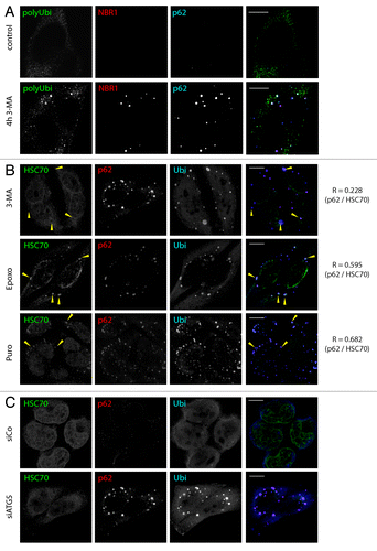 Figure 1. ALIS form upon autophagy inhibition, and differ from proteasome inhibition-induced aggregates. (A) HeLa cells were treated for 4 h with 3-MA (5 mM) or left untreated (control) and stained for polyubiquitinated proteins (FK1 antibody, polyUbi, green), NBR1 (red) and p62 (blue) prior to analysis by confocal microscopy. (B) HeLa cells were treated for 4 h with 3-MA (5 mM), Puromycin (5 µg/ml) or Epoxomycin (5 µM). Cells were stained for ubiquitinated protein (FK2 antibody, polyUbi, blue), HSPA8 (green), and p62 (red). Arrowheads indicate ALIS in the overlay and the corresponding area in the HSPA8 staining, respectively. Pearson’s coefficient (R) is given for the colocalization of p62 and HSPA8. (C) HeLa cells were transfected with siRNA against ATG5 (siATG5) or control siRNA (siCo) and stained for ubiquitinated protein (FK2 antibody, polyUbi, blue), HSPA8 (green) and p62 (red). Bar, 10 µm.