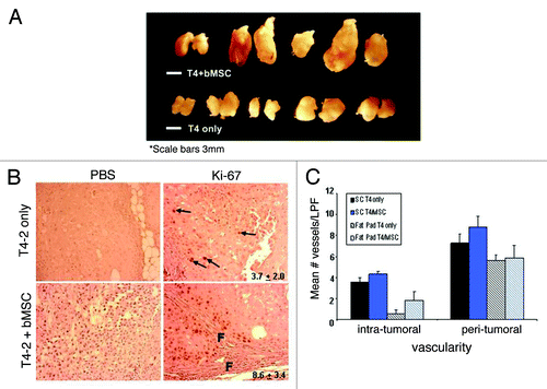 Figure 5. Breast MSCs promote the growth but not vascularity of HMT-3522 T4-2 cells. (A) 8-week HMT-3522 T4-2 cells (T4-2) ± bMSC3 fat pad xenografts (scale bar: 3mm). (B) Determination of the percent of Ki-67 positive cells per microscopic field revealed a statistically significant difference (p ≤ 0.011) between the pure and mixed xenografts. Representative immunohistochemical staining reveal that pure T4-2 xenografts contained only rare Ki-67 positive cells (arrows in top panels), whereas T4-2/bMSC xenografts often contained focal areas of active proliferation in close association with fibrosis (f = fibrosis). Primary antibody was omitted as a negative control for all specimens (left panels). Values indicated in the right panels represent mean percent Ki-67 positivity and were calculated based on counting the number of immunolabeled cells and then dividing by the total number of cells in 3 random fields per xenograft. (C) Intra- and peri-tumoral vascularity was not significantly different in T4-2 vs. T4-2/bMSC mixed xenografts whether injected orthotopically (patterned bars) or subcutaneously within Matrigel® (solid bars). Vascularity was determined on H&E stained tissue sections as described in Materials and Methods. LPF: low power field.