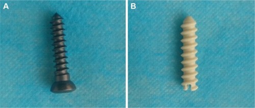 Figure 1 (A) The φ 3.5× (20–22) mm stainless-steel screw and (B) n-CDHA/PAA screw.Abbreviation: n-CDHA/PAA, nano-calcium-deficient hydroxyapatite/poly-amino acid.