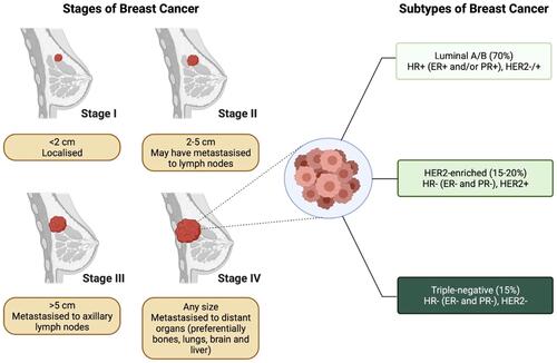 Figure 1 Stages and subtypes of breast cancer.