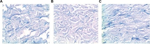 Figure 7 Alcian blue-stained dermal tissue from ex vivo hydrocortisone study.