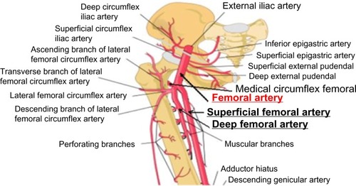 Figure 5 Common femoral artery and its branches around the inguinal canal.