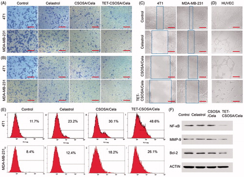 Figure 3. In vitro apoptosis and anti-metastasis effects of different formulations against 4T1 and MDA-MB-231 cells. Optical images of cells migration, (A) invasion, (B) and wound edge (C) after incubation for 12 h with 0.5 µg/mL of Celastrol, CSOSA/Cela, and TET-CSOSA/Cela. (D) Inhibition for the tube formation in HUVECs cells (bar =200 µm). (E) Apoptosis of Celastrol and Celastrol loaded micelles in 4T1 and MDA-MB-231 cells tested by Annexin V and analyzed by flow cytometry respectively. (F) The expression levels of NF-κB, MMP-9, and Bcl-2 in 4T1 cells were detected by Western blot.