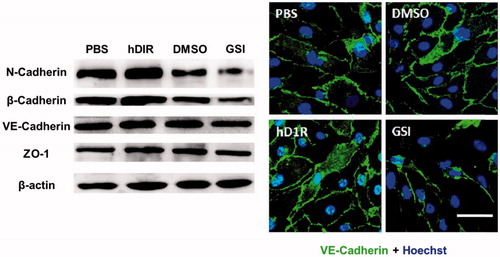 Figure 3. Left column: Notch signalling pathway regulates the expression of endothelial cell junction molecules; right column: Notch signalling regulates the expression of endothelial cell linker molecule VE-Cadherin.