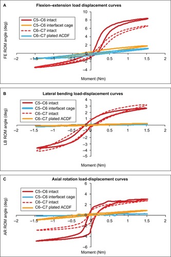 Figure 4 ROM curves with 0 N preload: (A) FE, (B) LB, and (C) AR.