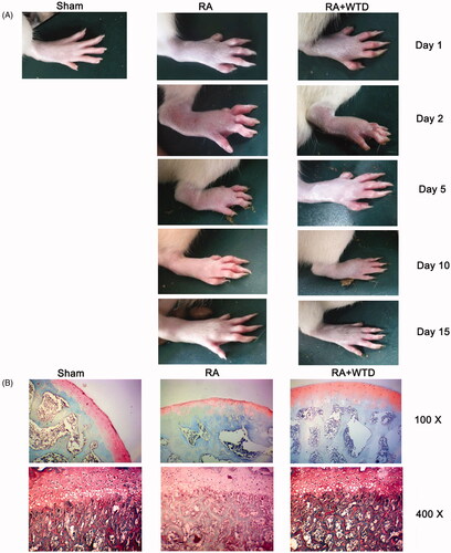 Figure 1. WTD attenuates RA in a rat model. Rats in the RA and RA + WTD groups were injected in the right hind footpad with 0.1 mL complete Freund’s adjuvant containing 10 mg/mL dead Mycobacterium tuberculosis. Rats in the RA + WTD group were additionally intragastrically administered WTD crude extract at a dose of 9.8 g/kg/day for 15 days. (A) The swelling of the hind paw was evaluated on days 1, 2, 5, 10, and 15. (B) The thickness of the articular cartilage layer in each group was evaluated by Safranin O/Fast Green staining.