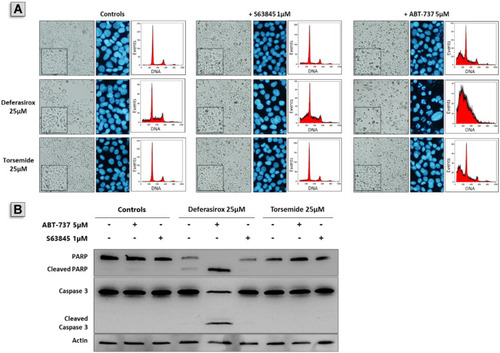 Figure 10 Effect of Deferasirox and Torsemide in combination with ABT-737 or S63845 on apoptosis on IGROV1-R10 cell line. Twenty-four hours after seeding, IGROV1-R10 ovarian cancer cells were exposed to 25 μM Deferasirox or Torsemide for 48 h in absence or presence of 5 μM ABT-737 or 1 μM S63845. (A) Effects of Deferasirox or Torsemide on cellular morphology, DNA content and nuclear morphology. (B) PARP and caspase 3 cleavage was assessed by Western blot in order to visualize apoptosis induction.