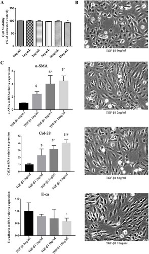 Figure 5. COL28 Overexpression promotes HK-2 cell EMT induced by TGF-β1. HK-2 cell viability was detected by CCK-8 under stimulation of TGF-β1 at different concentrations (A). Morphological changes in HK-2 cells are induced by different concentrations of TGF-β1 (B). Expression of E-cadherin, α-SMA, and endogenous COL28 mRNA in HK-2 cells induced by TGF-β1 at different concentrations (C). $p < 0.01 vs. TGF-β1 0 ng/ml, *p < 0.01 vs. TGF-β1 2 ng/ml, #p < 0.01 vs. TGF-β1 5 ng/ml. All experiments were performed three times.