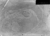 Figure 6 Immuno-electron microscope morphyological observation of MSCs (6700 ×) (JEOL100CX-II, Japan).