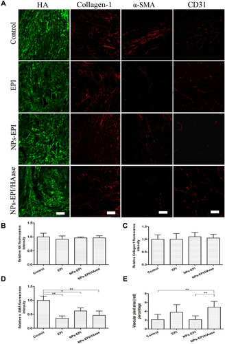 Figure 9 (A) Immunofluorescence imaging of tumor slices after treatment with saline, EPI, NPs-EPI and NPs-EPI/HAase. Saline-injected tumor slices were invoked as the control. The HA was stained with HABP, collagen I was stained with the anti-collagen I antibody, α-SMA was stained with the anti-α-SMA antibody, tumor blood vessels were stained with the anti-CD31 antibody, respectively. The nuclei of cells (blue) were stained with DAPI. Scale bar represents 100 μm. Quantitative analysis of HA (B), collagen I (C) and α-SMA (D) fluorescence intensity used Image J. The average fluorescence intensity of tumors from saline-treated mice was set as 1. (E) Statistic data of vascular pixel area (red) percentage of tumors slices used Image J. Values indicate mean ±SD (n=6 from 3 tumor samples per study group). *P<0.05, **P<0.01.