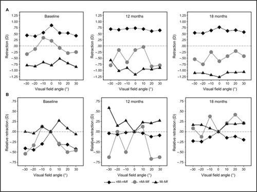 Figure 1 Peripheral refraction (A) and relative peripheral refraction (B) for the children in the “nonmyopia, myopia” classification at baseline (left), at 12 months (middle), and at 18 months (right).