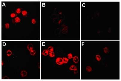 Figure 7 Distribution of doxorubicin in the multidrug-resistant K562 tumor cells. It was observed under confocal microscopy after incubating multidrug-resistant K562 tumor cells with free doxorubicin for (A) 0.5 hours, (B) 2 hours, (C) 8 hours, and doxorubicin-loaded copolymer polyethylene glycol-polycaprolactone micelles for (D) 30 minutes, (E) 2 hours, and (F) 8 hours.
